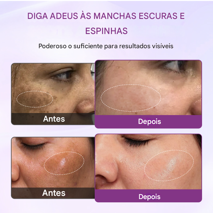 Biancat® RadiantClear Sérum Iluminador e Antimanchas