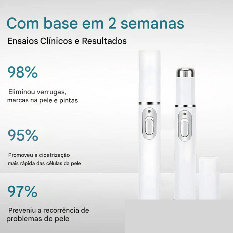 (Compre 1 LEVE 2)🔥 Caneta a Laser LOVILDS™ para Remoção de Sinais e Verrugas Sem Cirurgia ✅