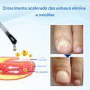 Biancat® OnyxoGuard Sérum para Crescimento e Reparação de Unhas