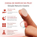 Adesivo Derma Smooth para Remoção de Sinais e Verrugas ✨