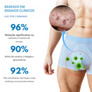 Oveallgo® NanoLipo Creme Removedor de Verrugas Genitais HPV