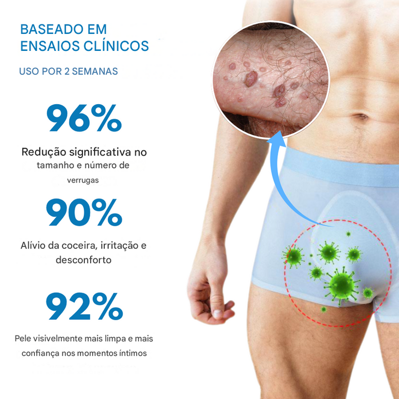 Oveallgo® NanoLipo Creme Removedor de Verrugas Genitais HPV
