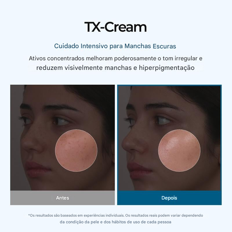 🧪 TX Cream – para Manchas Escuras e Hiperpigmentação ✨