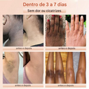 ⚡ Venda Flash ⚡ QUARXERY Esfoliante em Gel Suave ✨