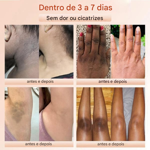 ⚡ Venda Flash ⚡ QUARXERY Esfoliante em Gel Suave ✨