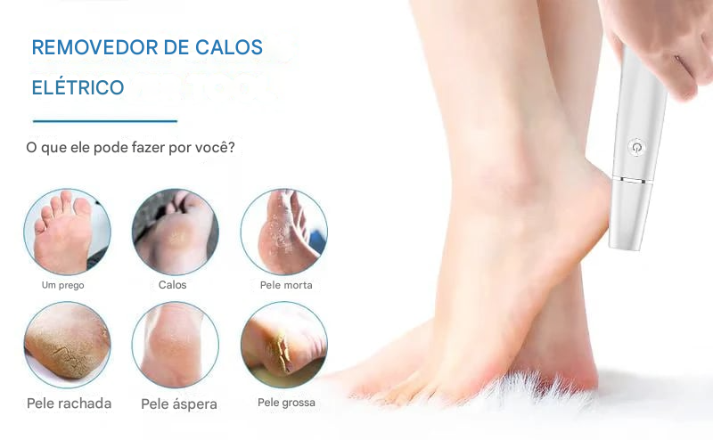 Removedor de calos elétrico para pés