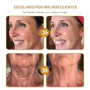 (Compre 1 Leve 2)🔥 Creme removedor de rugas Botox Bee Venom - 🐝 Promoção relâmpago: só hoje!