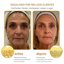 (Compre 1 Leve 2)🔥 Creme removedor de rugas Botox Bee Venom - 🐝 Promoção relâmpago: só hoje!